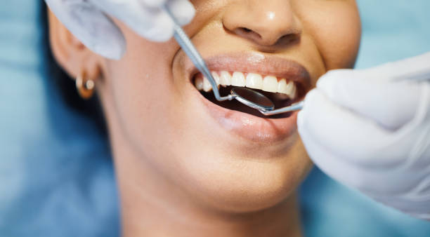Best Emergency Root Canal Treatment in Springville, UT